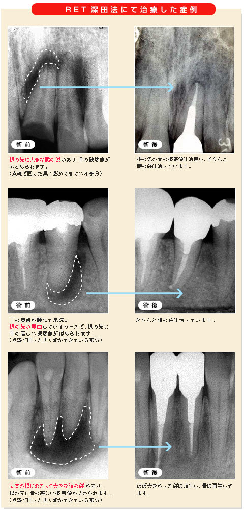 RET�[�c�@�ɂĎ��Â����Ǘ�