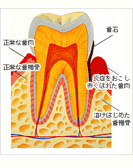 �����a�i�����^�R�j