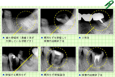 �����A�������Ìo�ߎʐ^