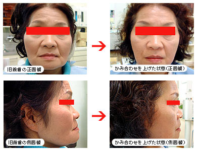 ���ꎕ�̃O���[�o���f���`���[�V�X�e��