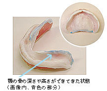 ���ꎕ�̃O���[�o���f���`���[�V�X�e��